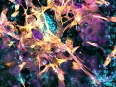 Cientistas aprendem mais sobre como embriões humanos se implantam usando úteros artificiais
| cinetotal.com.br Cientistas aprendem mais sobre como embriões humanos se implantam usando úteros artificiais
| cinetotal.com.br