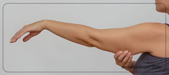 Lifting de braços e coxas no Irã
| cinetotal.com.br